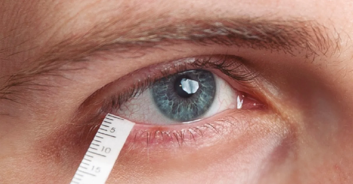 optometrist eye exam computer vision syndrome assessment